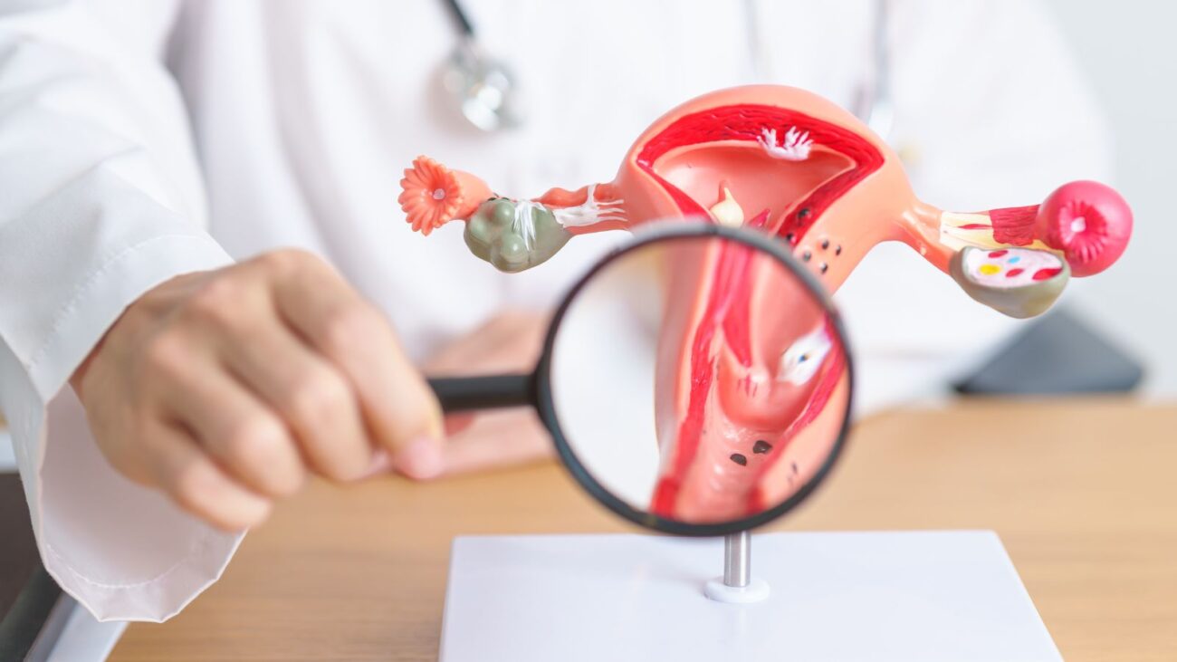 Entender el Síndrome de Ovario Poliquístico desde la medicina integrativa: más allá de los síntomas para recuperar tu bienestar.